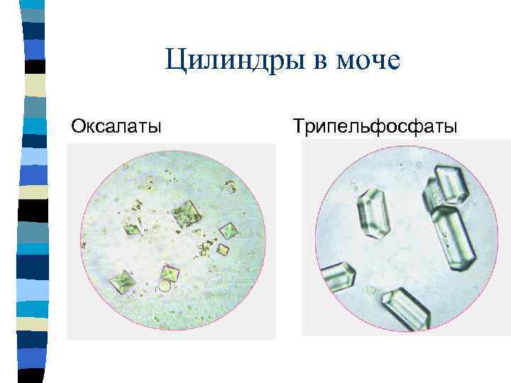 Осадки мочи под микроскопом в картинках и обозначения