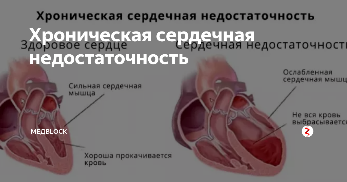 Заболевания сердца у собак