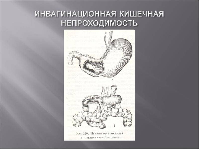 Хроническая толстокишечная диарея