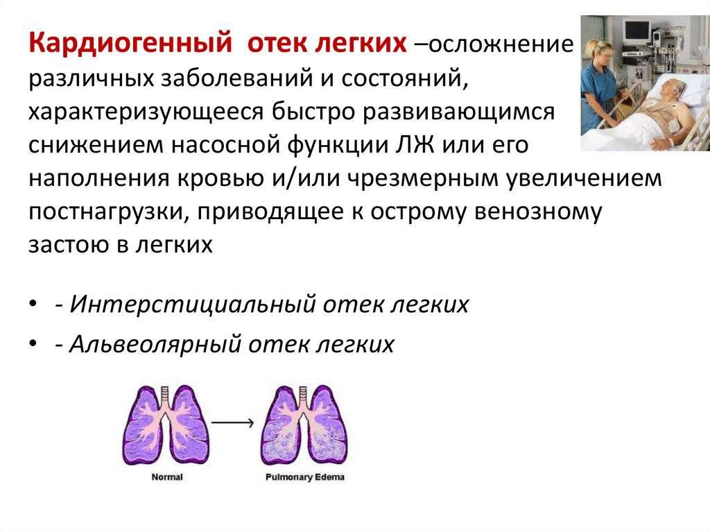 Отёк — чем может быть вызван этот симптом? - цэлт