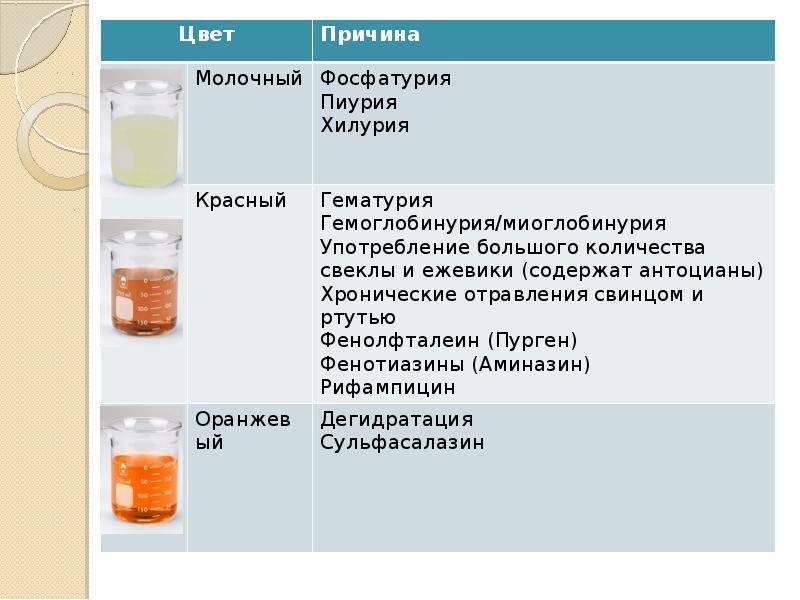 Моча пахнет краской для волос