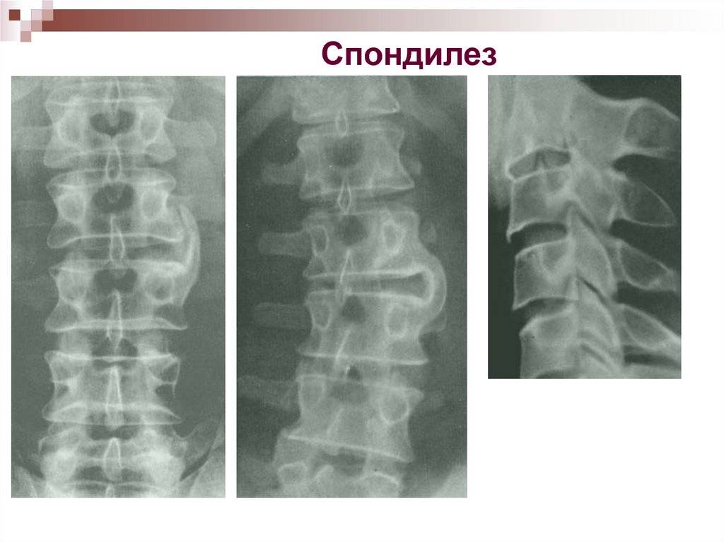 Спондилез у собаки: симптомы и лечение | причины, как вылечить