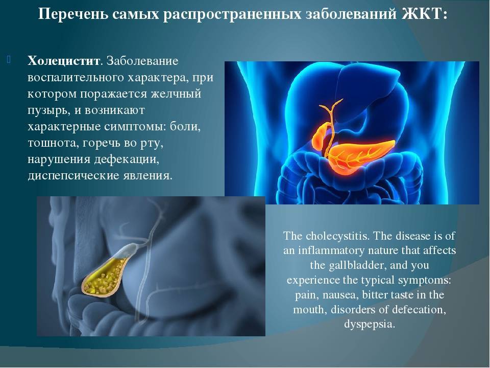 Проект на тему заболевания желудочно кишечного тракта