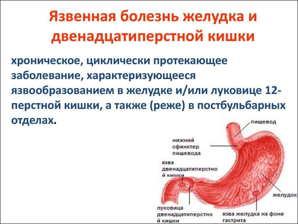 Язва желудка с кровотечением карта вызова