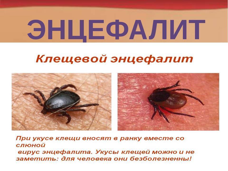 Клещевой энцефалит - симптомы, последствия, как не заразиться. что делать, если укусил клещ?