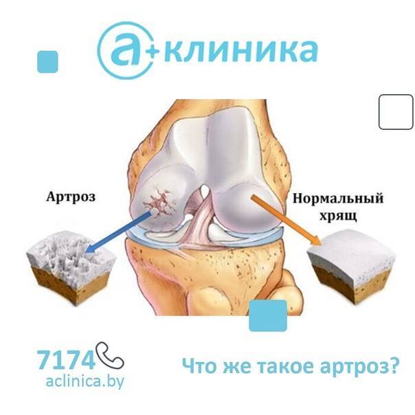 Укусила собака!