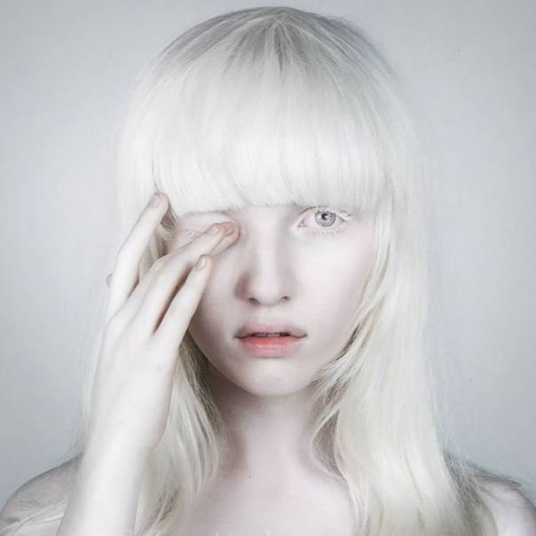 Кто такие альбиносы: признаки. сколько лет живут альбиносы люди, почему они долго не живут?