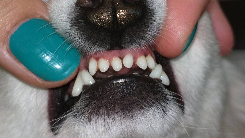 Как очистить зубной камень — стоматология комфорта