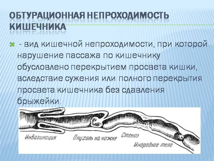 Непроходимость кишечника. причины, симптомы, диагностика и лечение кишечной непроходимости.