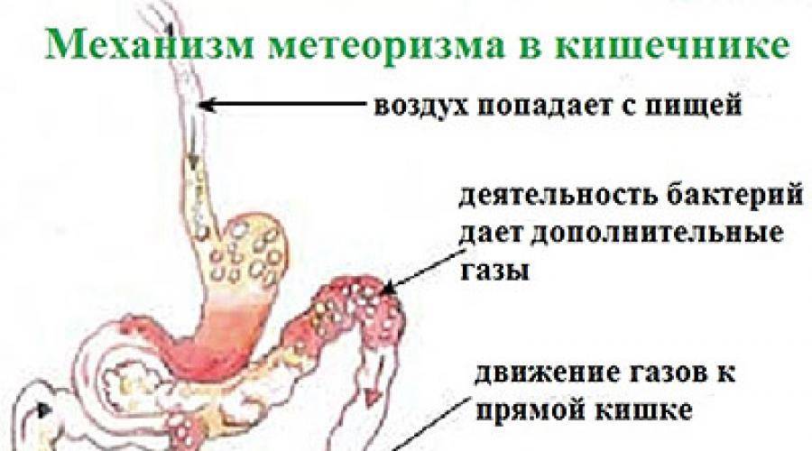 Онкологические заболевания органов жкт