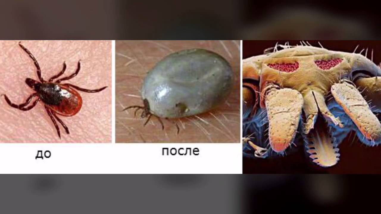 Иксодовые клещи