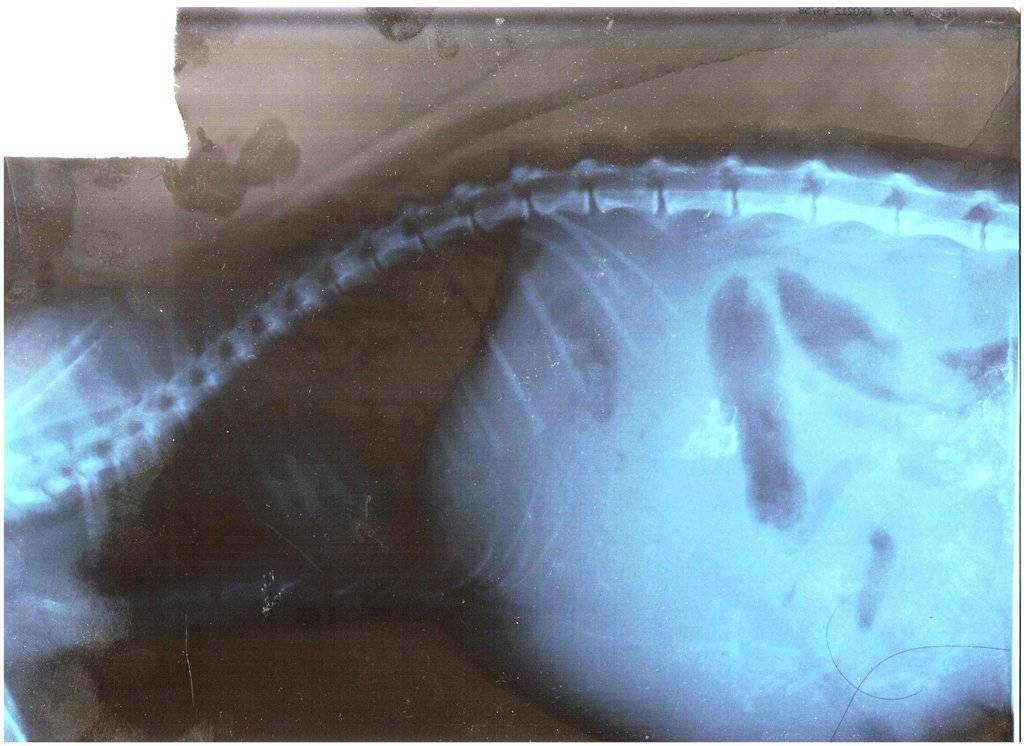 Рентгенография брюшной полости