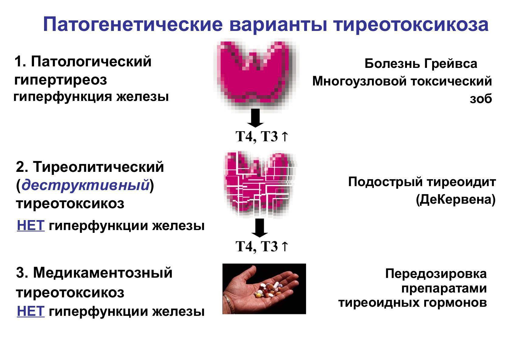 Гипертиреоз у детей презентация