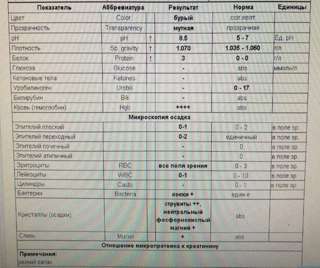 Белок в моче у собаки. ОАМ С микроскопией осадка расшифровка. Исследование мочи микроскопия нормы. Расшифровка анализа мочи плотность мочи норма. Норма белка в моче у кошек.