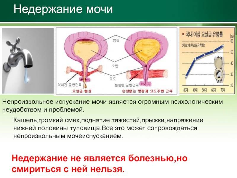 Мочеиспускание после удаления простаты