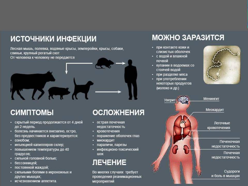 Клиническая картина гнилостной инфекции представлена всеми перечисленными симптомами за исключением