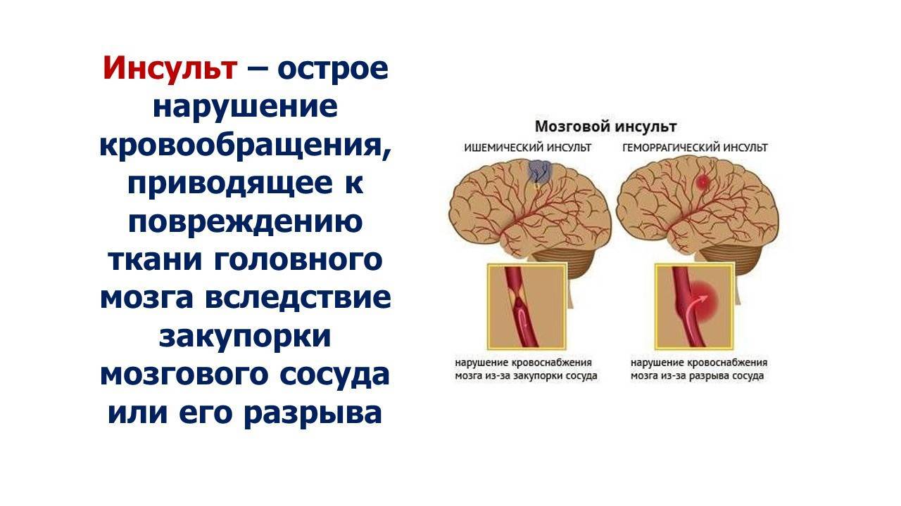 Консультация ветеринара: анализы крови собак, инсульт, координация
