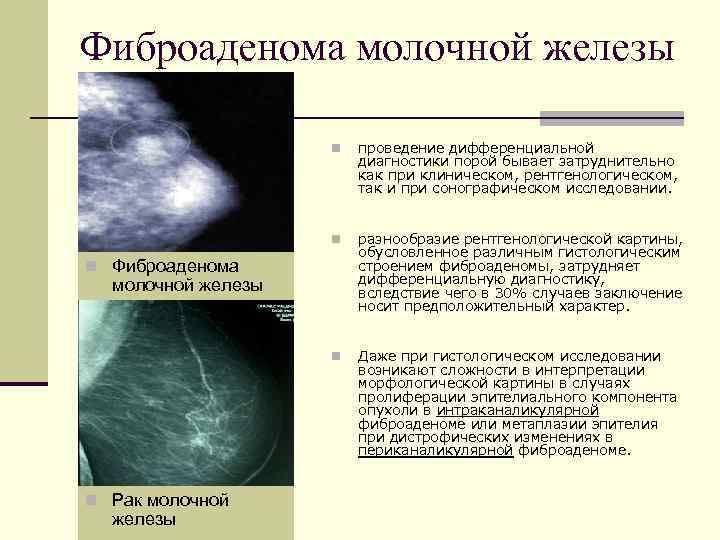 Рак молочной железы у кошки: почему появляется опухоль, как отличить её от мастопатии, лечение
